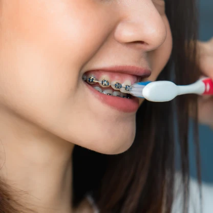 Child with braces brushing teeth, highlighting quality dentistry in Monrovia focused on healthy smiles